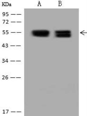 Western Blot: PKA 2 beta Antibody [NBP3-12636] - Lane A: NIH/3T3 Whole Cell LysateLane B: U-251 MG Whole Cell LysateLysates/proteins at 30 ug per lane.SecondaryGoat Anti-Rabbit IgG (H+L)/HRP at 1/10000 dilution.Developed using the ECL technique.Performed under reducing conditions.Predicted band size:46 kDaObserved band size:54 kDa