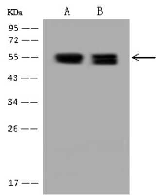 Western Blot: PKA 2 beta Antibody [NBP3-12636] - Anti-PKA 2 beta rabbit polyclonal antibody at 1:500 dilution.