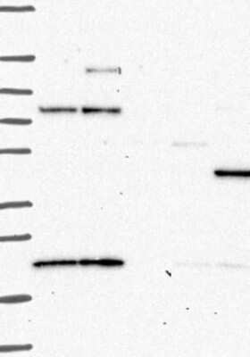 Western Blot: PKA 2 beta Antibody [NBP3-17753] - Lane 1: Marker [kDa] 250, 130, 95, 72, 55, 36, 28, 17, 10;   Lane 2: RT4;   Lane 3: U-251 MG;   Lane 4: Human Plasma;   Lane 5: Liver;   Lane 6: Tonsil