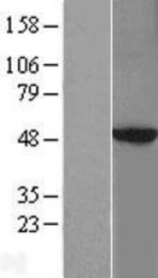 Western Blot: PKA 2 beta Overexpression Lysate (Adult Normal) [NBL1-14768] Left-Empty vector transfected control cell lysate (HEK293 cell lysate); Right -Over-expression Lysate for PKA 2 beta.