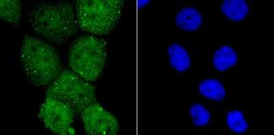 Immunocytochemistry/Immunofluorescence: PKA C alpha Antibody [NBP2-75620] - Staining PKA C-alpha in A431 cells (green). The nuclear counter stain is DAPI (blue). Cells were fixed in paraformaldehyde, permeabilised with 0.25% Triton X100/PBS.