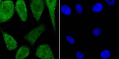 Immunocytochemistry/Immunofluorescence: PKA C alpha Antibody [NBP2-75620] - Staining PKA C-alpha in PC-3M cells (green). The nuclear counter stain is DAPI (blue). Cells were fixed in paraformaldehyde, permeabilised with 0.25% Triton X100/PBS.