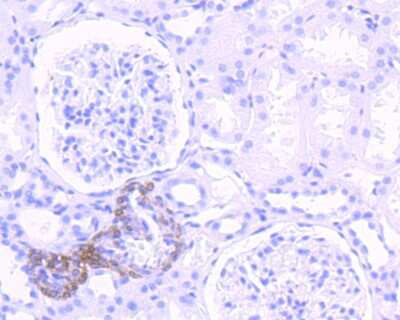 Immunohistochemistry-Paraffin: PKA C alpha Antibody [NBP2-75620] - Analysis of paraffin-embedded human kidney tissue using anti-PKA C-alpha antibody. Counter stained with hematoxylin.