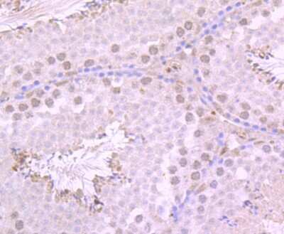Immunohistochemistry-Paraffin: PKA C alpha Antibody [NBP2-75620] - Analysis of paraffin-embedded mouse testis tissue using anti-PKA C-alpha antibody. Counter stained with hematoxylin.