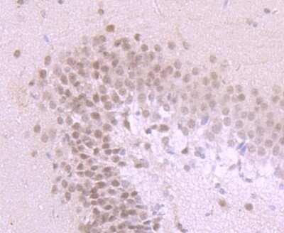 Immunohistochemistry-Paraffin: PKA C alpha Antibody [NBP2-75620] - Analysis of paraffin-embedded rat brain tissue using anti-PKA C-alpha antibody. Counter stained with hematoxylin.