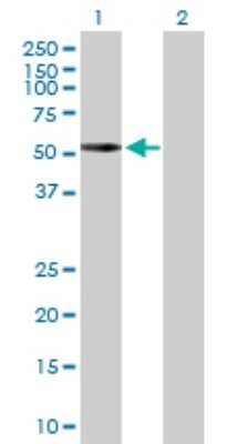 Western Blot: PKA C alpha Antibody [H00005566-D01P] - Analysis of PRKACA expression in transfected 293T cell line by PRKACA polyclonal antibody.Lane 1: PRKACA transfected lysate(40.60 KDa).Lane 2: Non-transfected lysate.