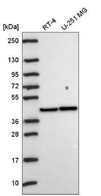 Western Blot: PKA C alpha Antibody [NBP2-57042] - Analysis in human cell line RT-4 and human cell line U-251 MG.