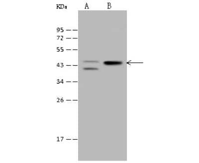 Western Blot: PKA C alpha Antibody [NBP2-99335] - Anti-PKA C alpha rabbit polyclonal antibody at 1:500 dilution. Lane A: HeLa Whole Cell Lysate Lane B: MCF-7 Whole Cell Lysate Lysates/proteins at 30 ug per lane. Secondary Goat Anti-Rabbit IgG (H+L)/HRP at 1/10000 dilution. Developed using the ECL technique. Performed under reducing conditions. Predicted band size: 40 kDa. Observed band size: 44 kDa