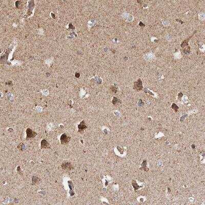 Immunohistochemistry-Paraffin: PKA C beta Antibody [NBP1-80901] - Staining of human cerebral cortex shows strong cytoplasmic positivity in neuronal cells.