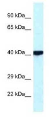 Western Blot: PKA C beta Antibody [NBP1-55008] - PKA C-beta Antibody [NBP1-55008] - Human Lung lysate.