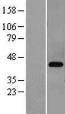 Western Blot: PKA C-beta Overexpression Lysate (Adult Normal) [NBL1-14758] Left-Empty vector transfected control cell lysate (HEK293 cell lysate); Right -Over-expression Lysate for PKA C-beta.