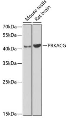 Western Blot: PKA C-gamma Antibody [NBP2-93404] - Analysis of extracts of various cell lines, using PKA C-gamma at 1:1000 dilution. Secondary antibody: HRP Goat Anti-Rabbit IgG (H+L) at 1:10000 dilution. Lysates/proteins: 25ug per lane. Blocking buffer: 3% nonfat dry milk in TBST. Detection: ECL Basic Kit . Exposure time: 90s.