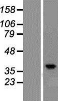 Western Blot: PKA C-gamma Overexpression Lysate (Adult Normal) [NBP2-10844] Left-Empty vector transfected control cell lysate (HEK293 cell lysate); Right -Over-expression Lysate for PKA C-gamma.
