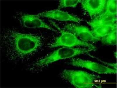 Immunocytochemistry/Immunofluorescence: PKA R2 Antibody (6A9) [H00005576-M01] - Analysis of monoclonal antibody to PRKAR2A on HeLa cell . Antibody concentration 10 ug/ml.