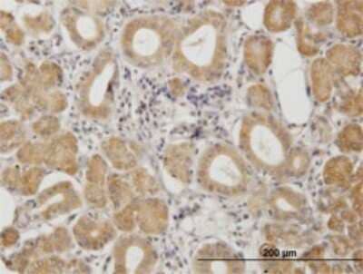 Immunohistochemistry-Paraffin: PKA R2 Antibody (6A9) [H00005576-M01] - Analysis of monoclonal antibody to PRKAR2A on formalin-fixed paraffin-embedded human salivary gland. Antibody concentration 3 ug/ml.