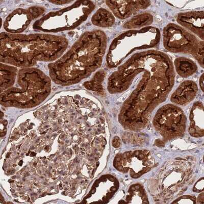 Immunohistochemistry: PKA R2 Antibody [NBP2-38399] - Staining of human kidney shows strong cytoplasmic and membranous positivity in cells in tubules.