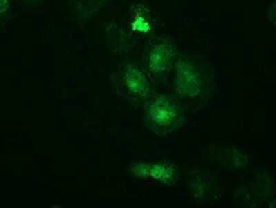 Immunocytochemistry/Immunofluorescence: PKA R2 Antibody (OTI1F8) - Azide and BSA Free [NBP2-73428] - Staining of COS7 cells transiently transfected by pCMV6-ENTRY PKA R2.