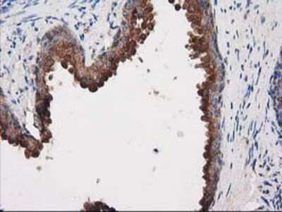 Immunohistochemistry: PKA R2 Antibody (OTI1F8) - Azide and BSA Free [NBP2-73428] - Staining of paraffin-embedded Human prostate tissue using anti-PKA R2 mouse monoclonal antibody.