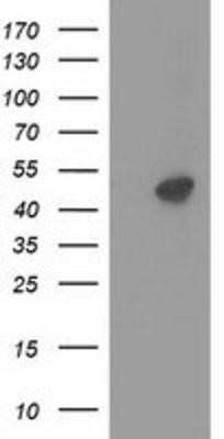 Western Blot: PKA R2 Antibody (OTI1F8) - Azide and BSA Free [NBP2-73428] - HEK293T cells were transfected with the pCMV6-ENTRY control (Left lane) or pCMV6-ENTRY PKA R2 (Right lane) cDNA for 48 hrs and lysed. Equivalent amounts of cell lysates (5 ug per lane) were separated by SDS-PAGE and immunoblotted with anti-PKA R2.