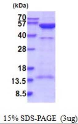 SDS-Page: PKA R2 Recombinant Protein [NBP2-52053] - 15% SDS Page (3 ug)