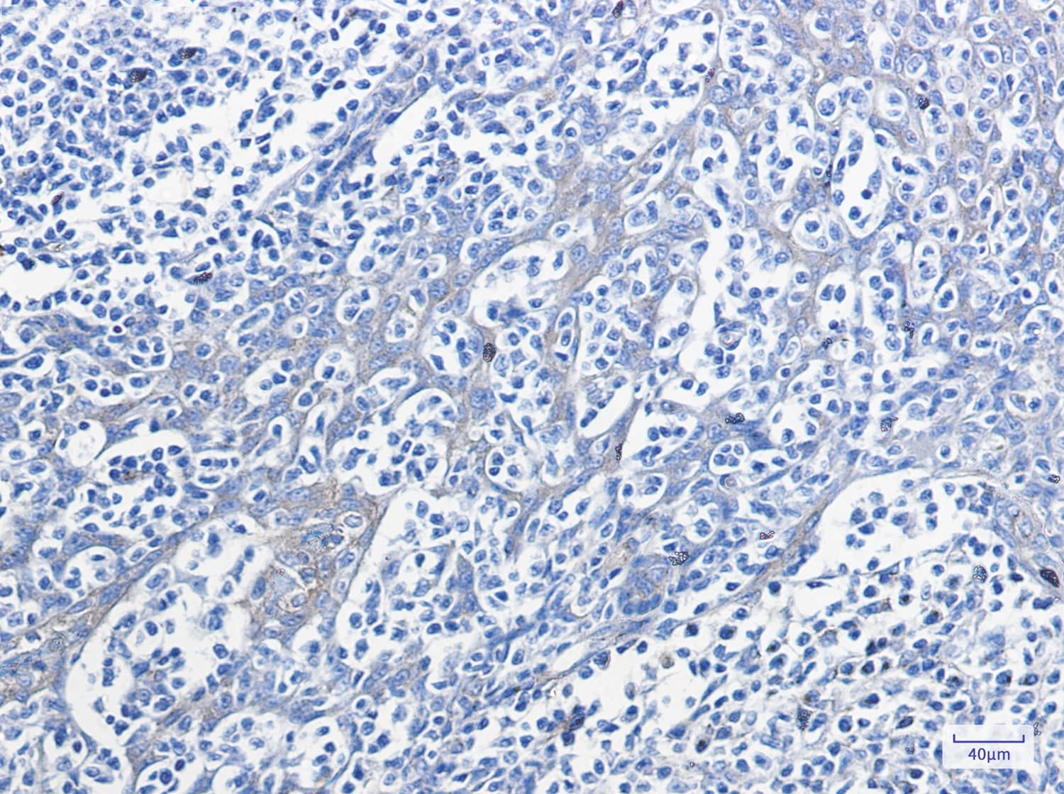 Immunohistochemistry-Paraffin: PKA R2 [p Ser99] Antibody (S05-7G2) [NBP3-19740] - Immunohistochemistry of PKA R2 (Phospho-Ser99) in paraffin-embedded Human tonsil using NBP3-19740 at dilution 1/100