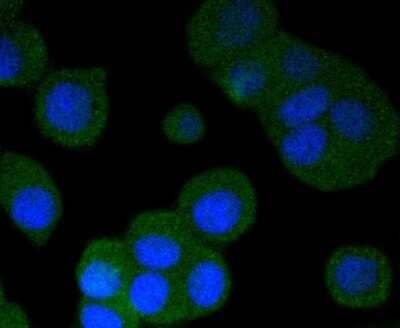 Immunocytochemistry/Immunofluorescence: PKA R2 [p Ser99] Antibody (SC54-04) [NBP2-67571] - Staining phospho-PKA R2 (S99) in MCF-7 cells (green). The nuclear counter stain is DAPI (blue). Cells were fixed in paraformaldehyde, permeabilised with 0.25% Triton X100/PBS.