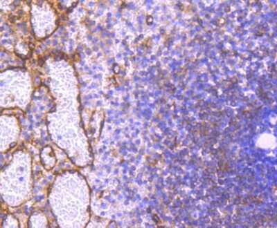 Immunohistochemistry-Paraffin: PKA R2 [p Ser99] Antibody (SC54-04) [NBP2-67571] - Analysis of paraffin-embedded human spleen tissue using anti- phospho-PKA R2 (S99) antibody. Counter stained with hematoxylin.