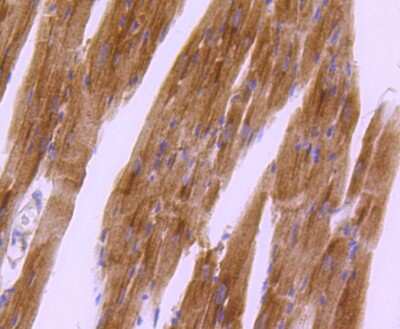 Immunohistochemistry-Paraffin: PKA R2 [p Ser99] Antibody (SC54-04) [NBP2-67571] - Analysis of paraffin-embedded mouse heart tissue using anti- phospho-PKA R2 (S99) antibody. Counter stained with hematoxylin.