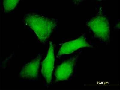 Immunocytochemistry/Immunofluorescence: PKA RI beta Antibody [H00005575-B01P] - Analysis of purified antibody to PRKAR1B on HeLa cell. (antibody concentration 10 ug/ml)