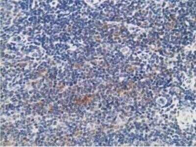 Immunohistochemistry: PKA RI beta Antibody (OTI2A3) - Azide and BSA Free [NBP2-73430] - Staining of paraffin-embedded Human lymph node tissue using anti-PKA regulatory subunit I beta mouse monoclonal antibody.