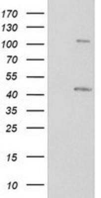 Western Blot: PKA RI beta Antibody (OTI2A3) - Azide and BSA Free [NBP2-73430] - HEK293T cells were transfected with the pCMV6-ENTRY control (Left lane) or pCMV6-ENTRY PKA regulatory subunit I beta (Right lane) cDNA for 48 hrs and lysed. Equivalent amounts of cell lysates (5 ug per lane) were separated by SDS-PAGE and immunoblotted wi