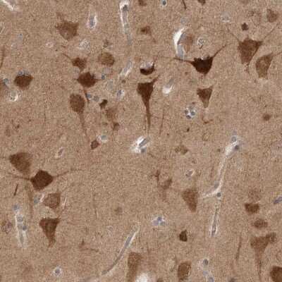 Immunohistochemistry-Paraffin: PKA RI beta Antibody [NBP1-87451] -  Staining of human cerebral cortex shows strong cytoplasmic positivity in neuronal cells.