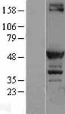 Western Blot PKA RI beta Overexpression Lysate