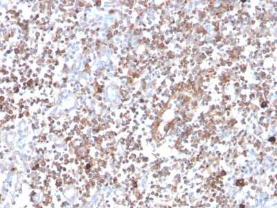 Immunohistochemistry-Paraffin: PKC alpha Antibody (133) - Azide and BSA Free [NBP3-08229] - Formalin-fixed, paraffin-embedded human tonsil stained with PKC alpha Mouse Monoclonal Antibody (133).