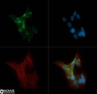 Immunocytochemistry/Immunofluorescence: PKC alpha Antibody (MC5) - Azide and BSA Free [NBP2-80911] - PKC alpha (MC5) antibody was tested in SH-SY5Y cells with Dylight 488 (green). Nuclei and beta-tubulin were counterstained with DAPI (blue) and Dylight 550 (red). Image from the standard format of this antibody.