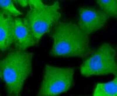 Immunocytochemistry/Immunofluorescence: PKC alpha Antibody (SU31-08) [NBP2-67457] - Staining PKC alpha in A549 cells (green). The nuclear counter stain is DAPI (blue). Cells were fixed in paraformaldehyde, permeabilised with 0.25% Triton X100/PBS.