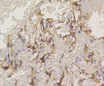 Immunohistochemistry-Paraffin: PKC alpha Antibody (SU31-08) [NBP2-67457] - Analysis of paraffin-embedded human lung tissue using anti-PKC alpha antibody. Counter stained with hematoxylin.