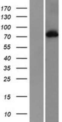 Western Blot: PKC alpha Overexpression Lysate (Adult Normal) [NBP2-04234] Left-Empty vector transfected control cell lysate (HEK293 cell lysate); Right -Over-expression Lysate for PKC alpha.