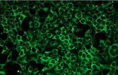 Immunocytochemistry/Immunofluorescence: PKC beta Antibody (A10-F) [NBP1-30122] - Expression in HEK293 cells.