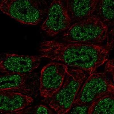 Immunocytochemistry/Immunofluorescence: PKC beta Antibody [NBP2-54928] - Staining of human cell line RT4 shows localization to nucleoplasm.