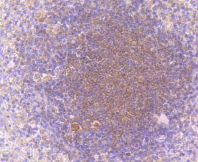 Immunohistochemistry-Paraffin: PKC beta Antibody (JM43-26) [NBP2-67062] - Analysis of paraffin-embedded human spleen tissue using anti-PKC beta 1 antibody. Counter stained with hematoxylin.
