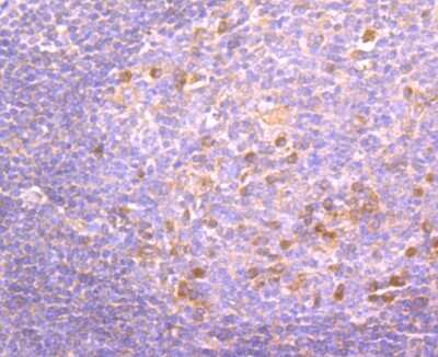 Immunohistochemistry-Paraffin: PKC beta Antibody (JM43-26) [NBP2-67062] - Analysis of paraffin-embedded human tonsil tissue using anti-PKC beta 1 antibody. Counter stained with hematoxylin.
