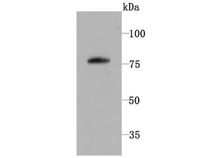 Western Blot: PKC beta Antibody (JM43-26) [NBP2-67062] - Analysis of PKC beta 1 on L929 cell using anti-PKC beta 1 antibody at 1/1,000 dilution.