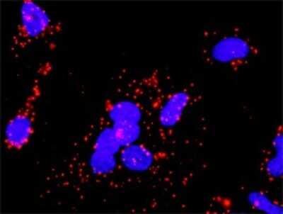 Proximity Ligation Assay: PKC beta Antibody [H00005579-D01P] - Analysis of protein-protein interactions between PRKCB and CHUK. HeLa cells were stained with anti-PRKCB rabbit purified polyclonal 1:1200 and anti-CHUK mouse monoclonal antibody 1:50. Each red dot represents the detection of protein-protein interaction complex, and nuclei were counterstained with DAPI (blue).