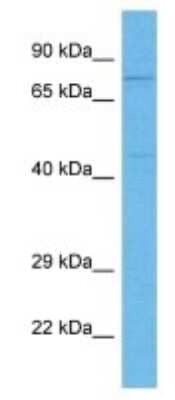 Western Blot: PKC beta Antibody [NBP3-09962] - Western blot analysis of PKC beta in Human ACHN Whole Cell lysates. Antibody dilution at 1ug/ml