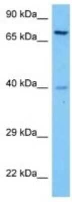 Western Blot: PKC beta Antibody [NBP3-10285] - Western blot analysis of PKC beta in Human K562 Whole Cell lysates. Antibody dilution at 1ug/ml