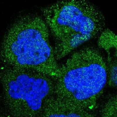 Immunocytochemistry/Immunofluorescence: PKC delta Antibody [NBP1-90957] - Staining of human cell line A-431 shows localization to cytosol. Antibody staining is shown in green.