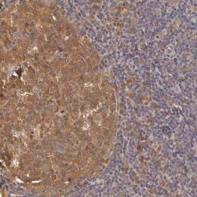 Immunohistochemistry: PKC delta Antibody [NBP1-90957] - Staining of human tonsil shows strong cytoplasmic positivity in germinal center cells.