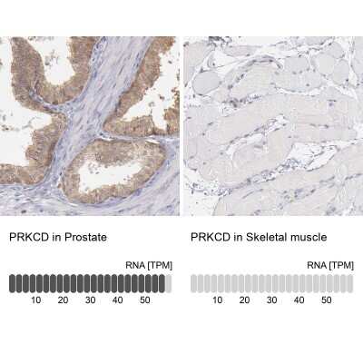 Immunohistochemistry-Paraffin: PKC delta Antibody [NBP1-90351] - Staining in human prostate and skeletal muscle tissues using anti-PRKCD antibody. Corresponding PRKCD RNA-seq data are presented for the same tissues.