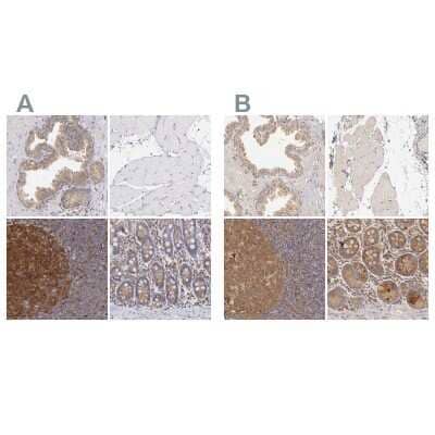 <b>Independent Antibodies Validation. </b>Immunohistochemistry-Paraffin: PKC delta Antibody [NBP1-90351] - Staining of human prostate, skeletal muscle, tonsil and upper gastrointestinal using Anti-PKC delta antibody NBP1-90351 (A) shows similar protein distribution across tissues to independent antibody NBP1-90957 (B).